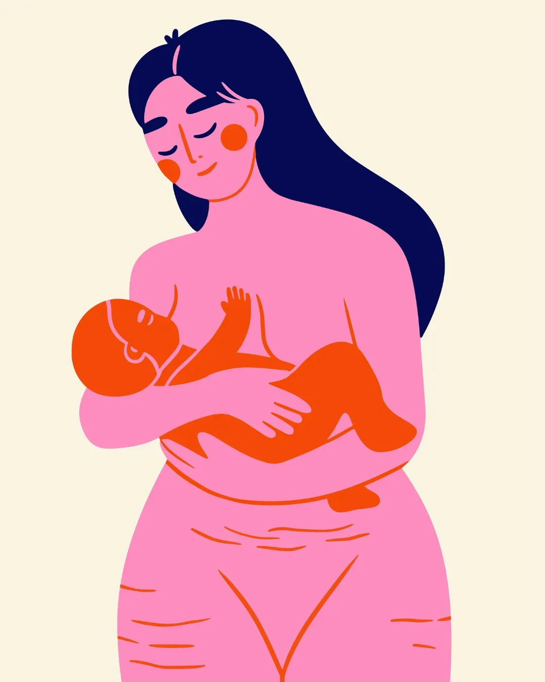Illustration post-partum